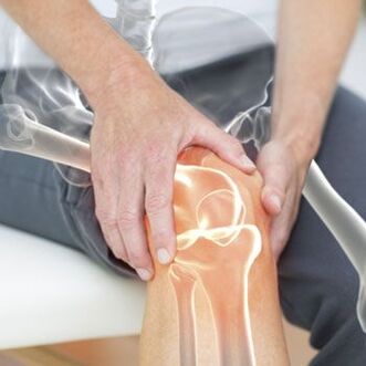 El dolor de rodilla puede ser causado por una dislocación. 
