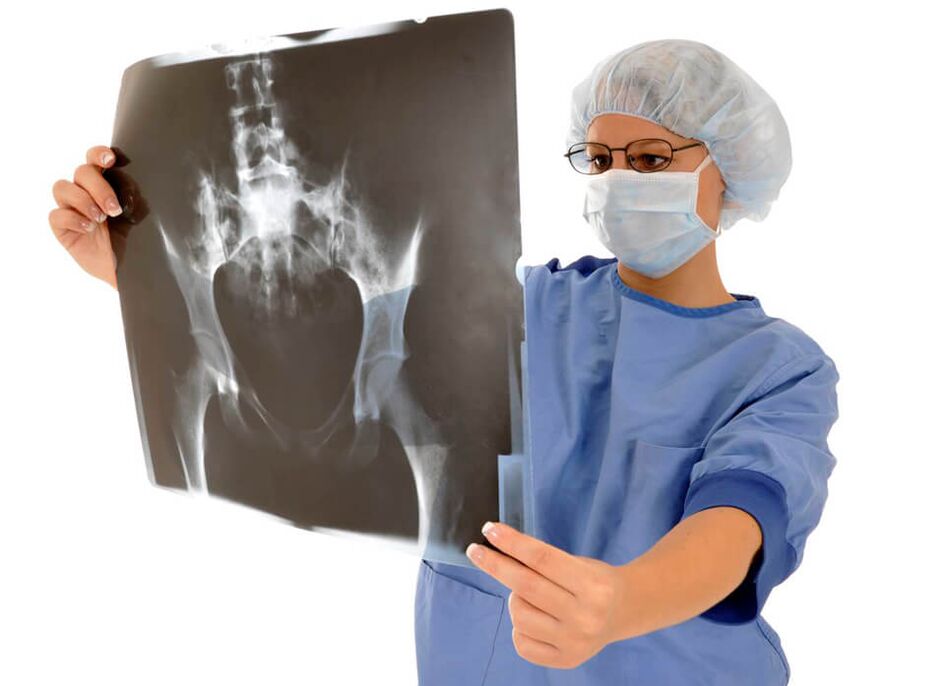 Una radiografía de la articulación de la cadera ayuda al médico a determinar la causa del dolor. 