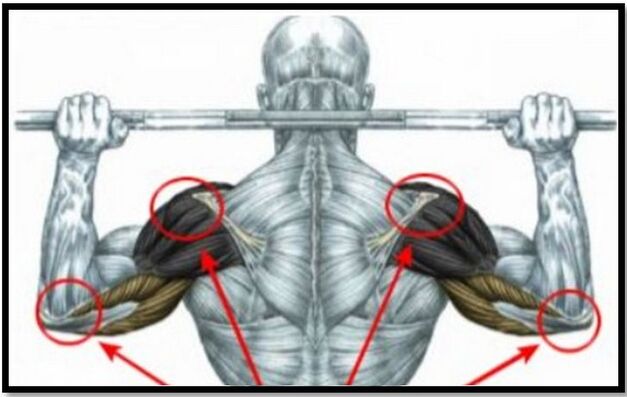 La tensión en los músculos del hombro y del codo es una de las causas de la osteoartritis de la articulación del hombro. 