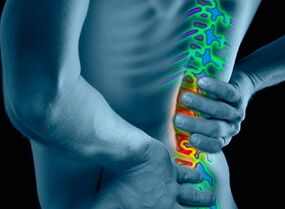 Causas y síntomas de la osteocondrosis